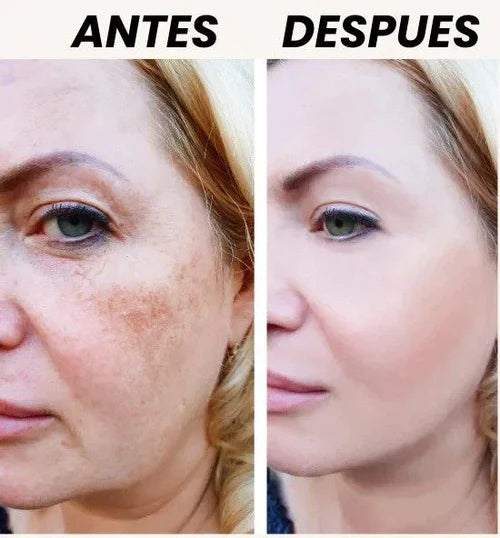 Zamia Lumina – Crema Aclarante Natural