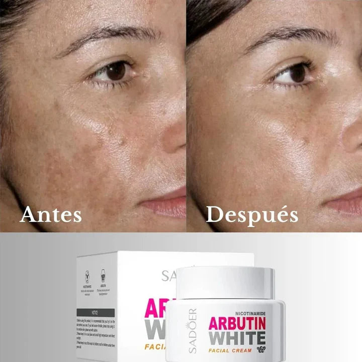 Reinicia tu piel, borra manchas, revive tu brillo - ARBUTINE WHITE
