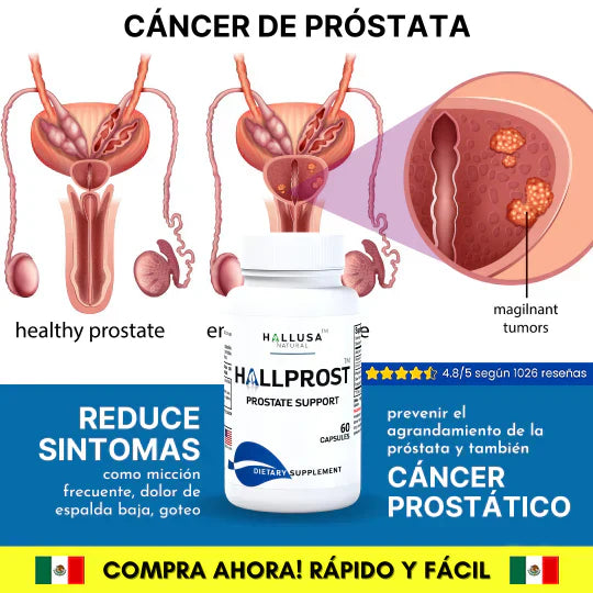 HALLPROST Tratamiento Completo – TOP DE VENTAS