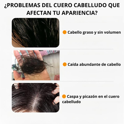 Shampoo Anti-Caída Remimpi – Cabello más fuerte y sano