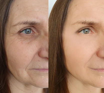 Collagen Boost™ | Reduce Líneas y Arrugas - 24 KITS de Parches de Colágeno Intensivos